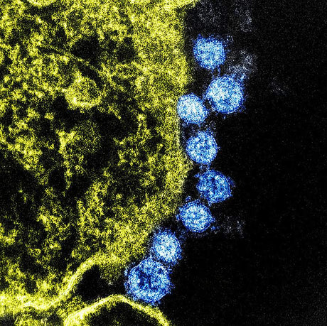 Obligatory Coronavirus Update